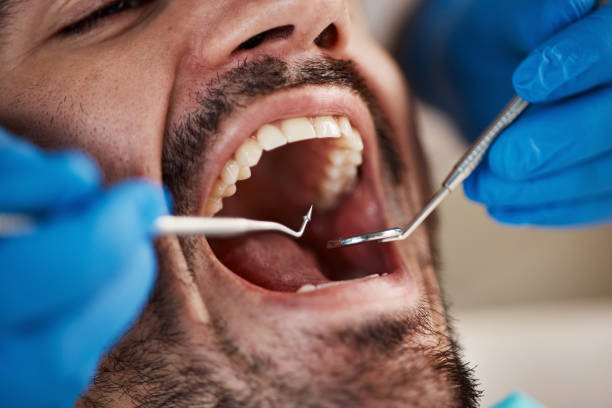 Best Walk-In Emergency Dentist in Tipton, IN