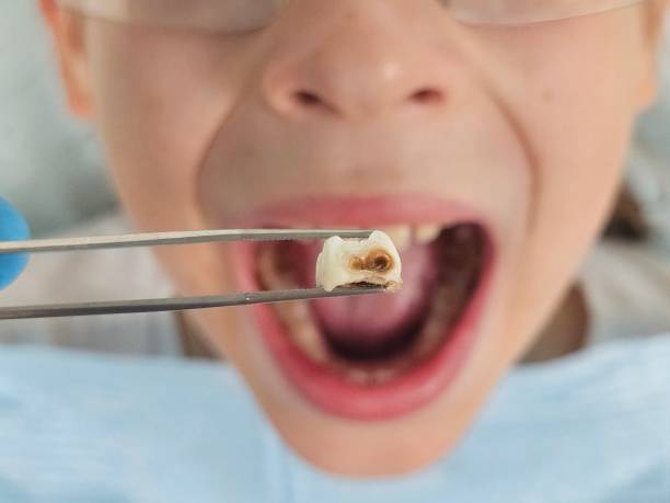Best Same-Day Emergency Dentist in Tipton, IN
